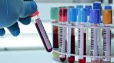 Laboratoires de biologie médicale (LBM) : droit de propriété des sites d’exercice